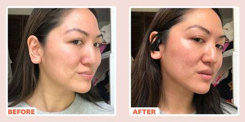 Microcurrent Handset | 6-in-1 Skin Care Device | EMS + Light Therapy | Rechargeable