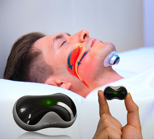 Anti Snoring Device | Electro-Stimulation Mouthpiece for Peaceful Sleep | USB Rechargeable